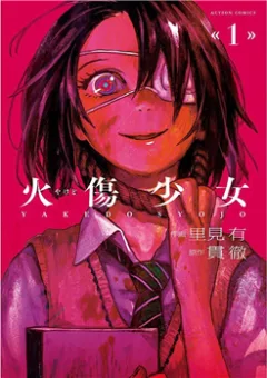 Yakedo Shoujo